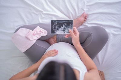 Ultrasound, scan, viability, growth scan, anomaly scan