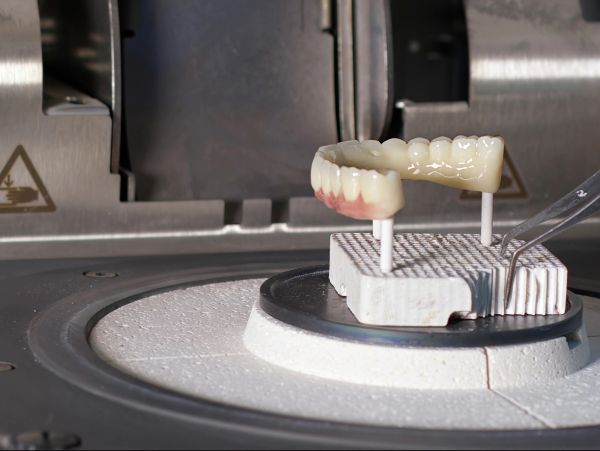 Milled dental zirconia prosthetics being prepared.