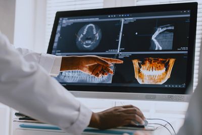 Doctor pointing at dental X-rays on a computer screen during consultation.