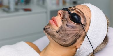 Woman undergoing a facial treatment with a charcoal mask and protective goggles.