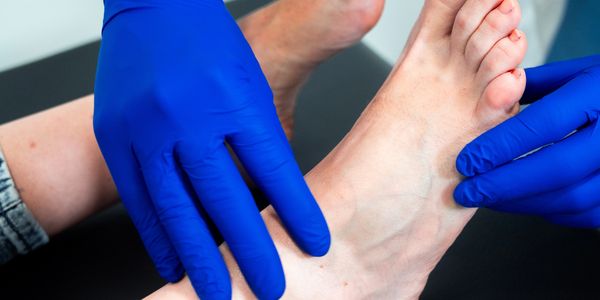 Gloved hands examining a person's foot closely.