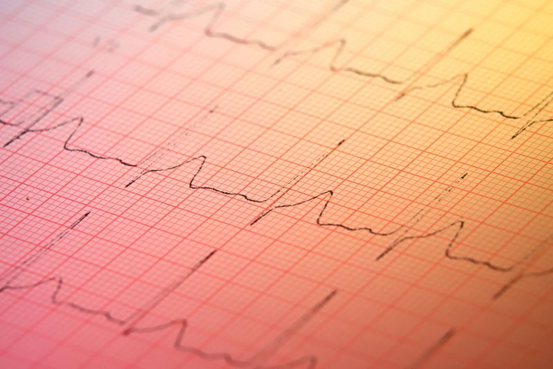 elektrokardiogram heart rate measurement chart