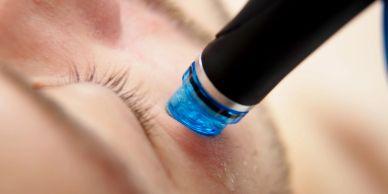 Close-up of a facial treatment device on skin.
