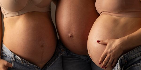 Three pregnant women standing side by side, showing their baby bumps.