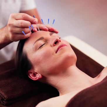 facial acupuncture