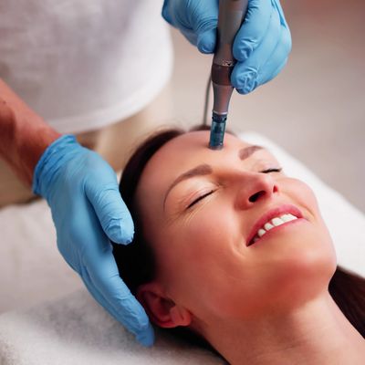 Skin Needling New Farm Brisbane award winning skin and laser clinic anti-ageing treatments book now