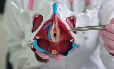 Doctor holding and pointing to a pelvic anatomical model.