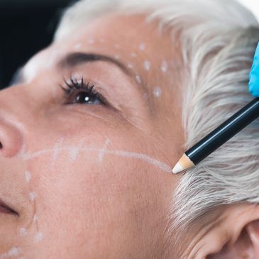 Treatments available to address volume loss concerns 