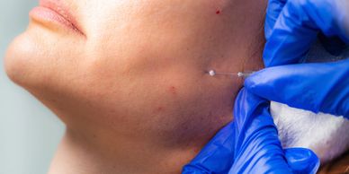 PDO Threads in Columbus GA