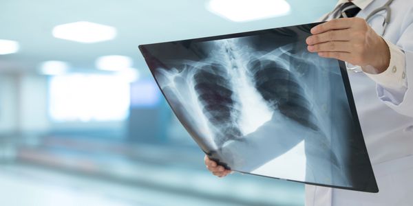 Advanced treatment of severe lung infections by pulmonologist