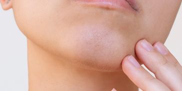 Close-up of a person touching their chin with visible skin texture.