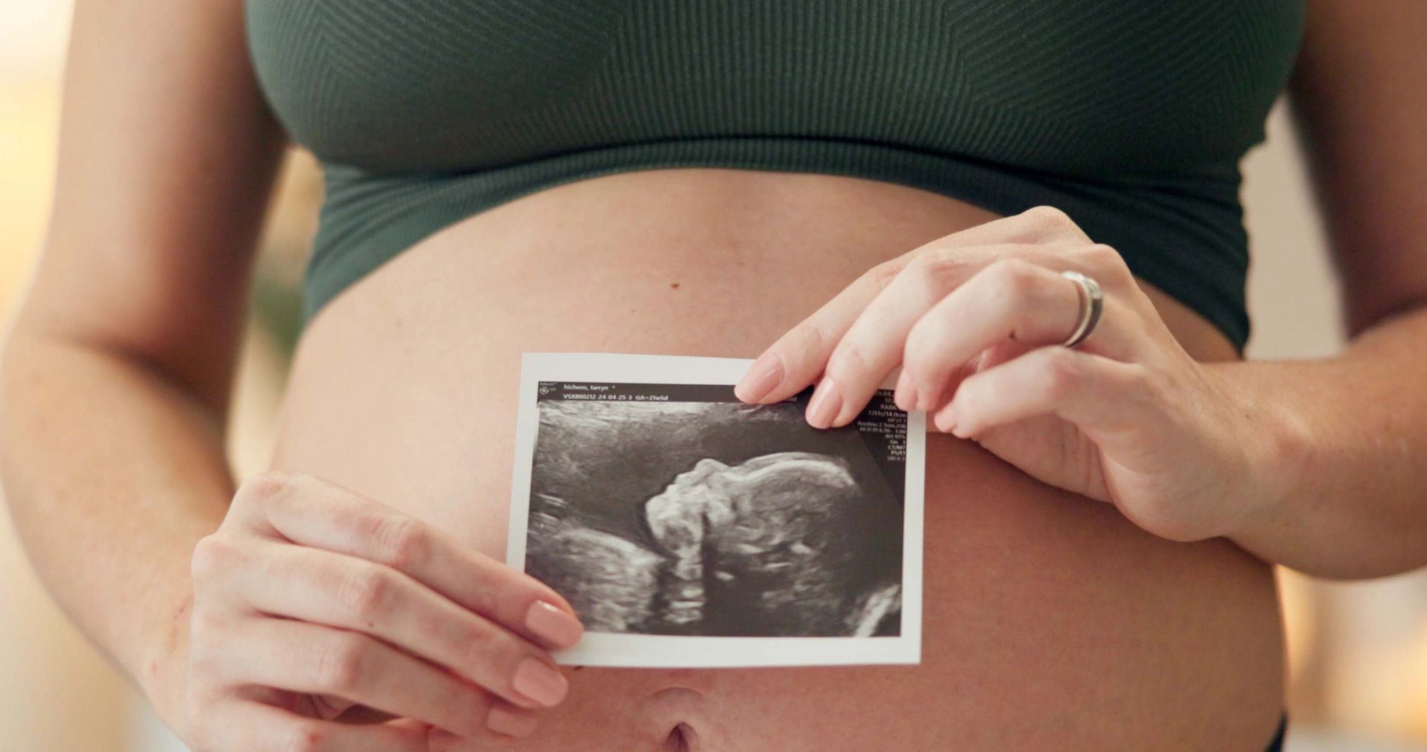 Pregnant woman holding ultrasound image over belly.