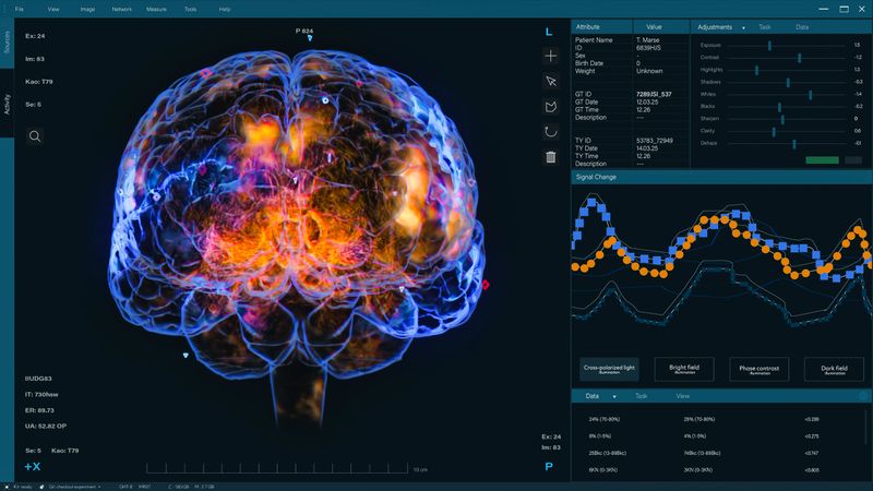 3D VFX Animation of a Brain Scan in Medical Software, Visualization of Neural Activity, Data Visualization. Screen Replacement for Medical Hospitals and Software Engineers in Brain Research Science