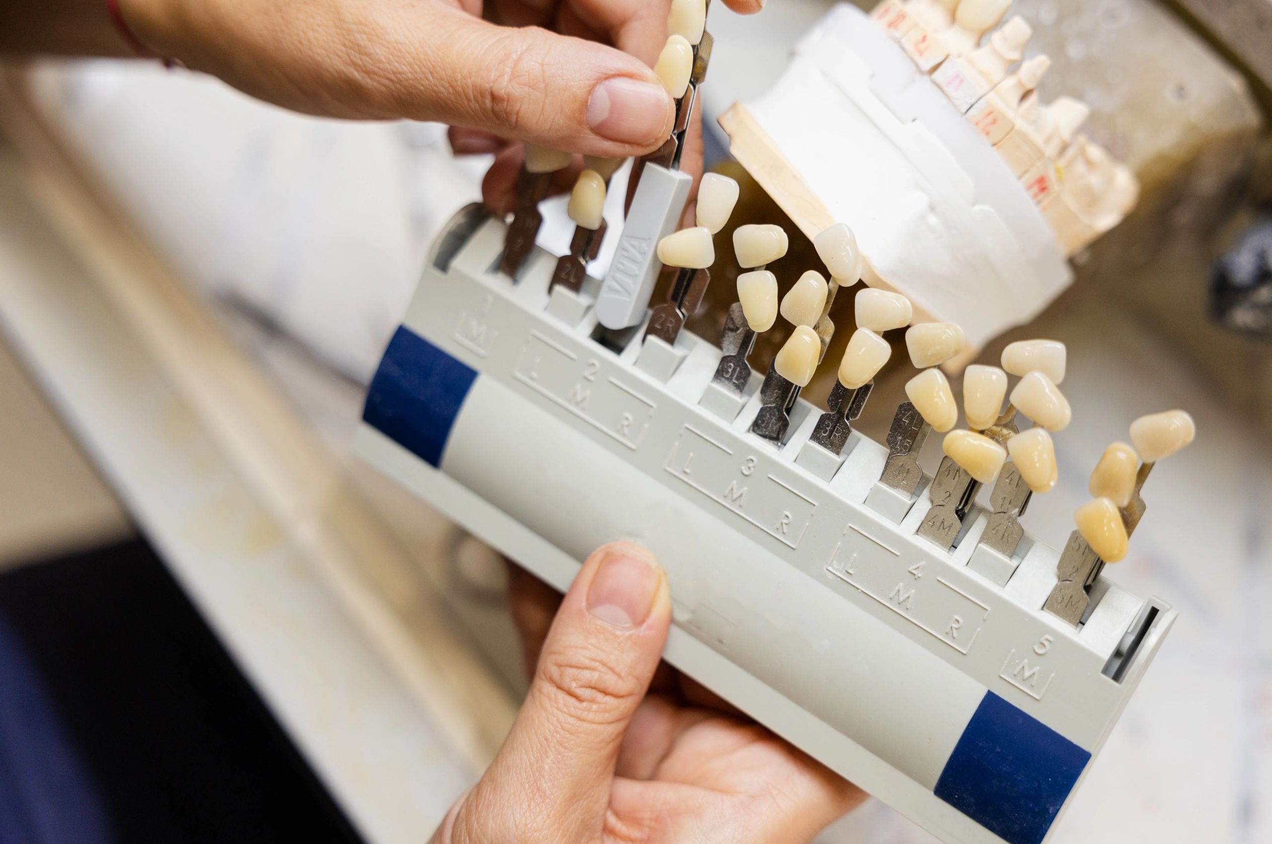 Quality Dental Lab For Exceptional Dental Restorations