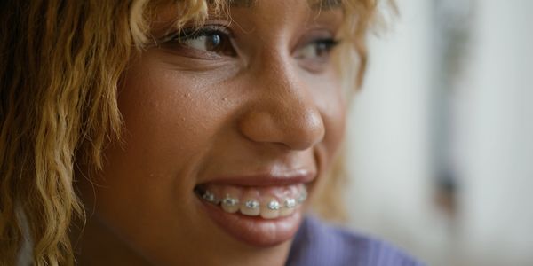 Close-up of a smiling person with braces.