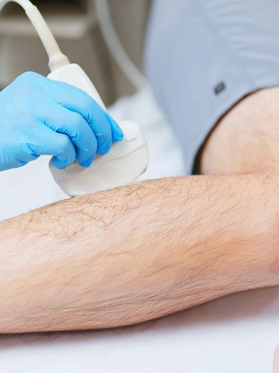 Medical ultrasound on a person's arm.