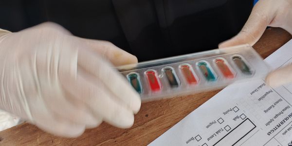 Person wearing gloves holding a multi-color test strip over a form on a wooden table.