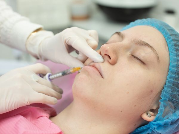 Tratamiento de armonización facial con Acido Hialurónico en Castelldefels