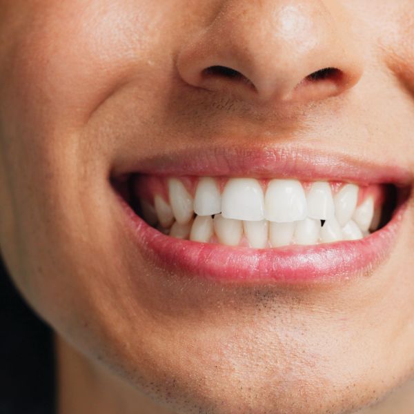 Close-up of a smiling mouth showing white teeth.