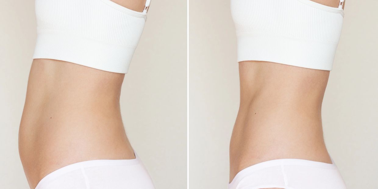 Side-by-side comparison of a woman’s stomach before and after toning.