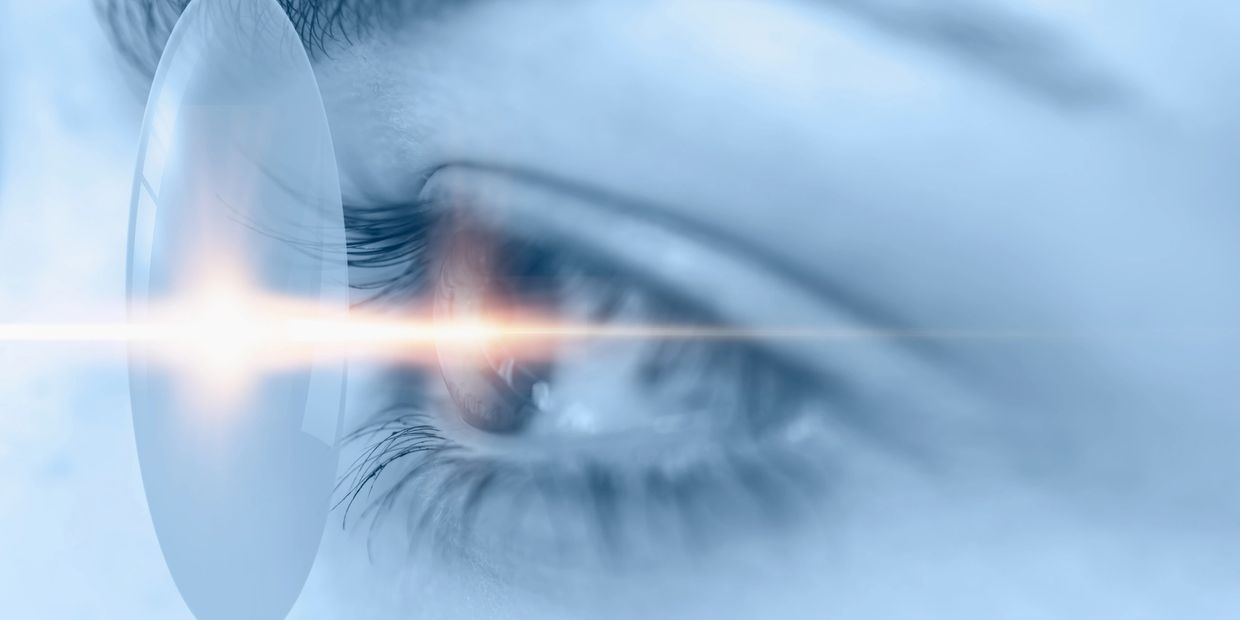 Keratopigmentation Surgery Connecticut 424-478-9157