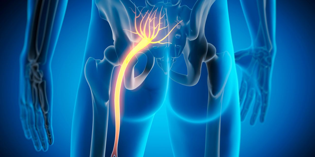 Illustration of the sciatic nerve highlighted in yellow in a transparent human body.