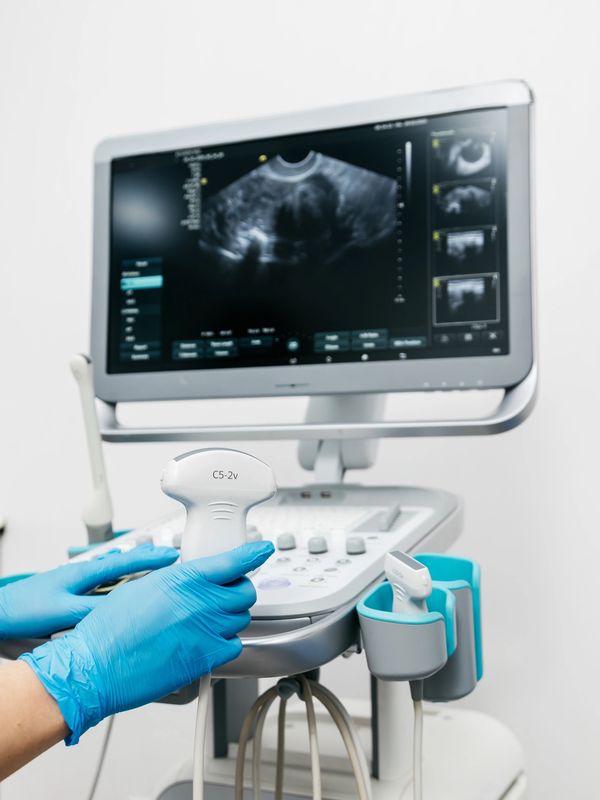 Intraabdominal cyst treated at  the Grant Scott Bonham Fetal Center at Primary Childrens Hospital