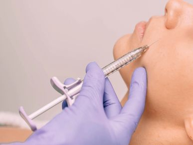  hyaluronic acid micro droplet injection