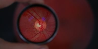 Close-up of an eye's retina viewed through a magnifying lens.