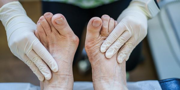 Healthcare worker examining elderly patient's feet with gloves on.