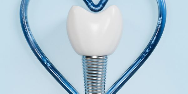 Dental implant with a stethoscope shaped like a heart on a blue background.