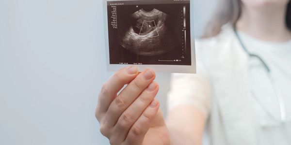 Médico mostrando resultado de ecografía obstétrica, diagnóstico prenatal en Guayaquil.