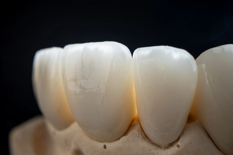Dental health care. Ceramic zirconium in final version. Close up dental zircon ceramic crowns on black background