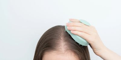 Hair Restoration Columbus GA