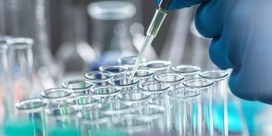 Scientist using pipette with test tubes in lab.