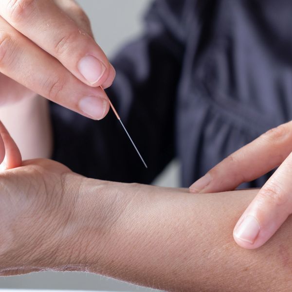 Acupuncture needle inserted into wrist.