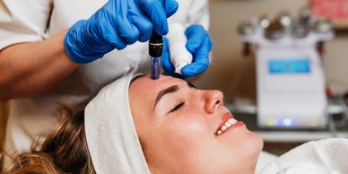 Advanced collagen production and skin rejuvenation with Salmon Sperm DNA and Microneedling 
