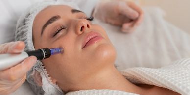 Microneedling with Peptides Columbus GA
