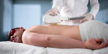 back hair and chest hair reduction by laser hair removal 