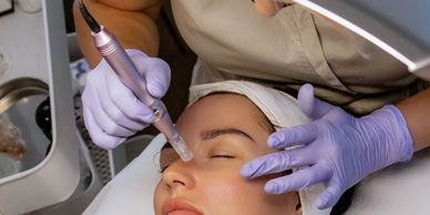Microneedling in Columbus GA