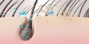 Close-up of hair follicle with moisture and dirt particles.