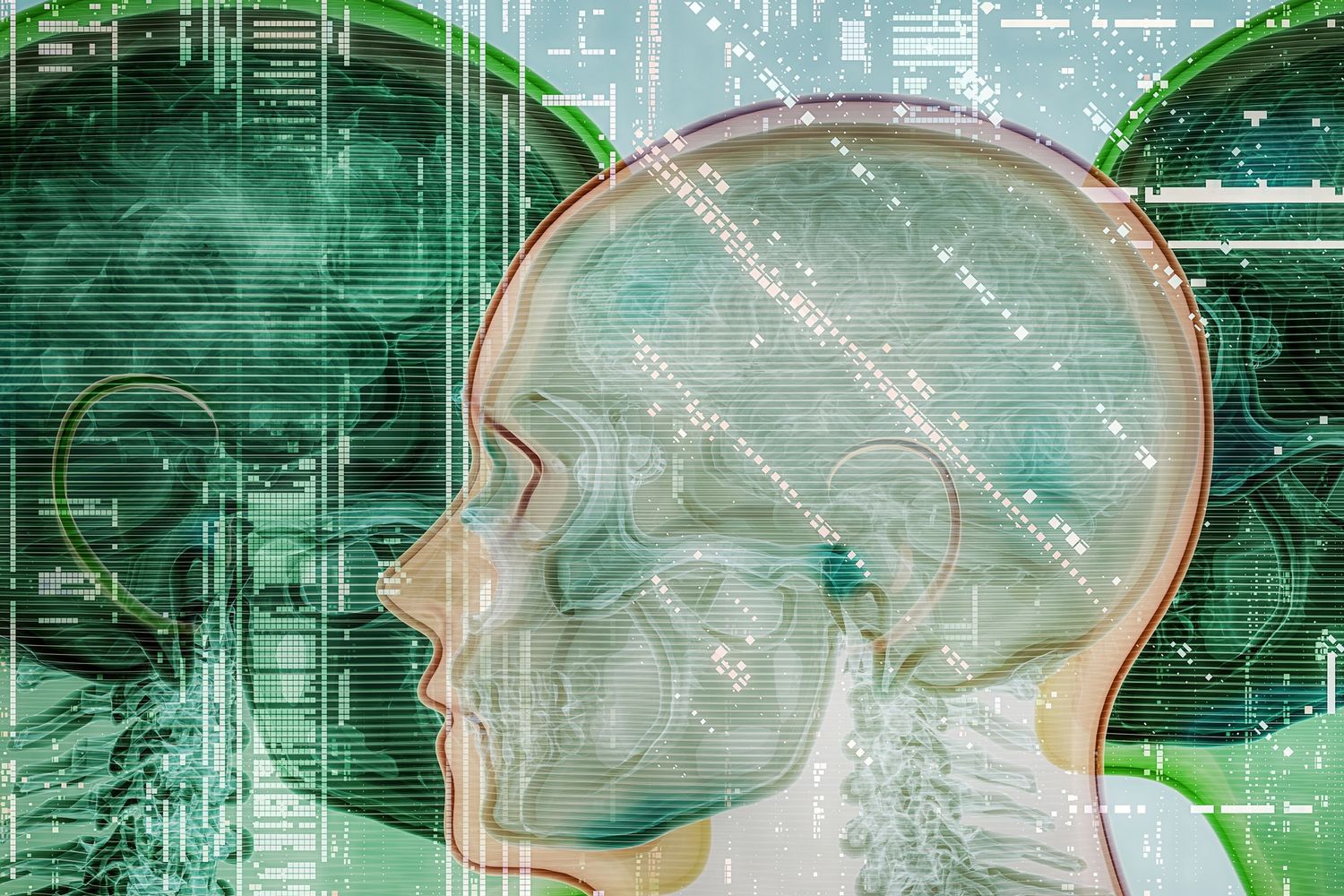 A child wearing a yellow hat sleeps in bed connected to a medical device.