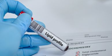 Gloved hand holding a blood sample labeled lipid profile.