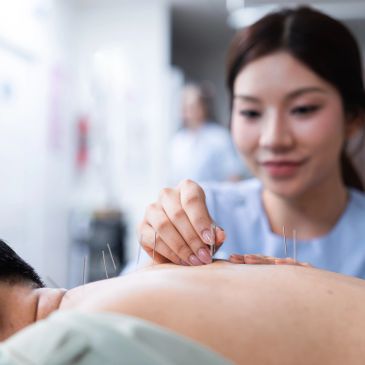Acupuncturist inserting needles into patient's back.