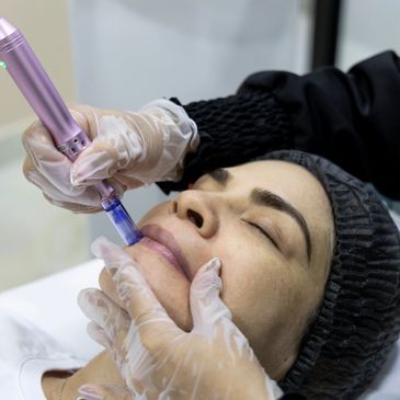 Woman receiving lip treatment with a device.