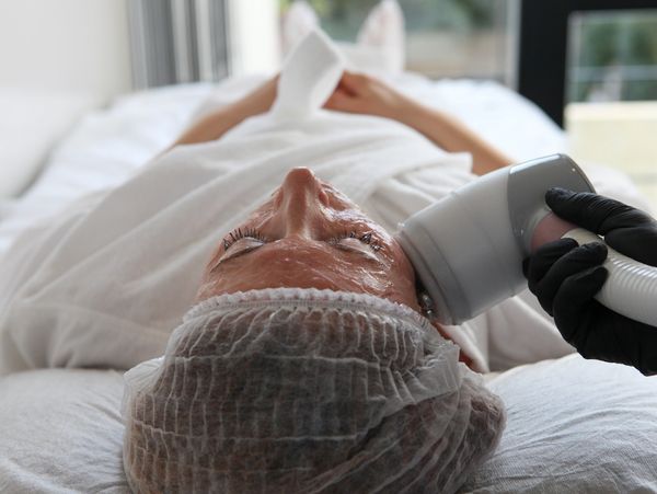 Tratamiento de Rejuvenecimiento facial con HIFU en Castelldefels