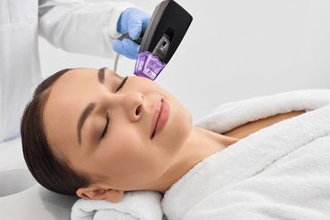 Radiofrequency microneedling - skin tightening  &  rejuvination , SavaSana Aesthetics , Coleford 