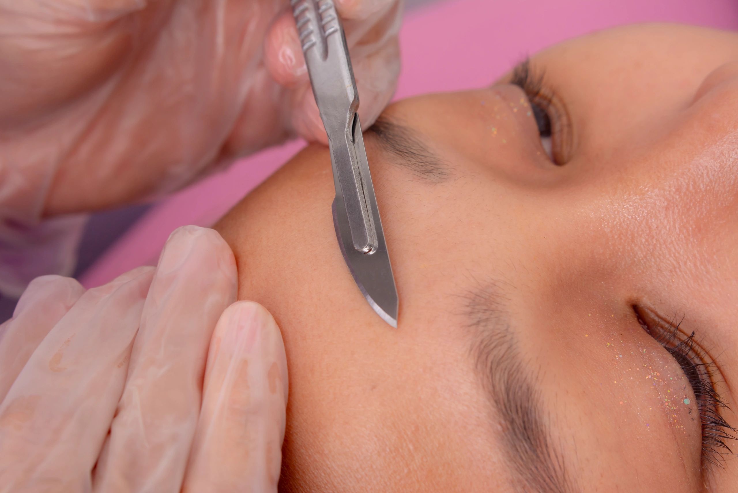 Dermaplane skincare in Woburn, MA