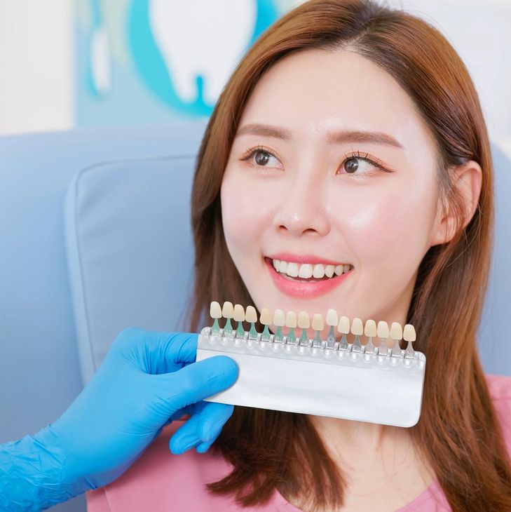 Patient with a whitened smile being matched against a shade guide