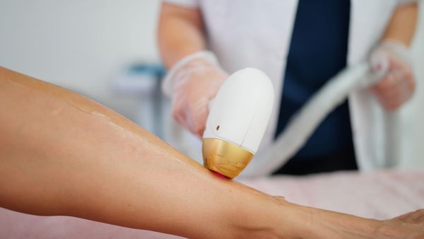 Close-up of laser hair removal treatment on a person's leg.